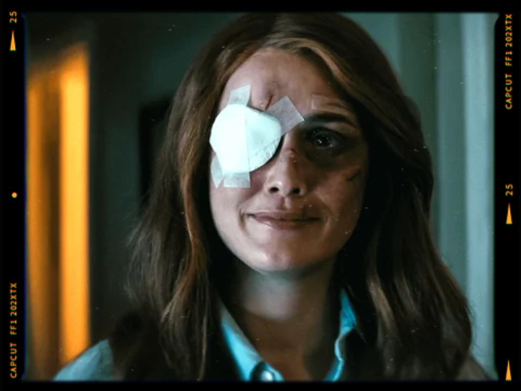 A woman with long brown hair is smiling while wearing an eye patch over her left eye, showing visible bruising and scratches on her face.
